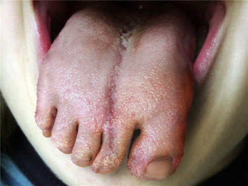 The Miracles of Photoshop