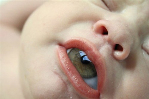 The Miracles of Photoshop