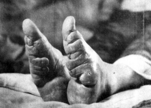 Chinese Foot Binding Tradition