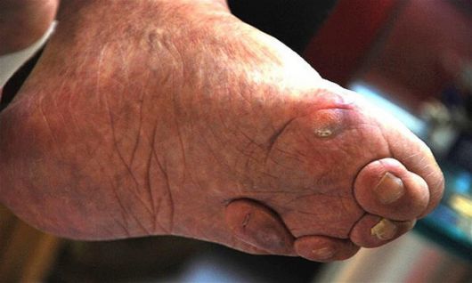 Chinese Foot Binding Tradition