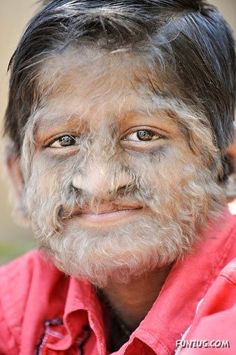 Amazing Hair Boy from India