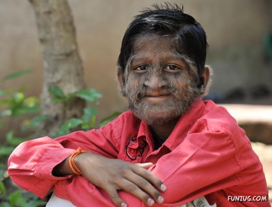 Amazing Hair Boy from India