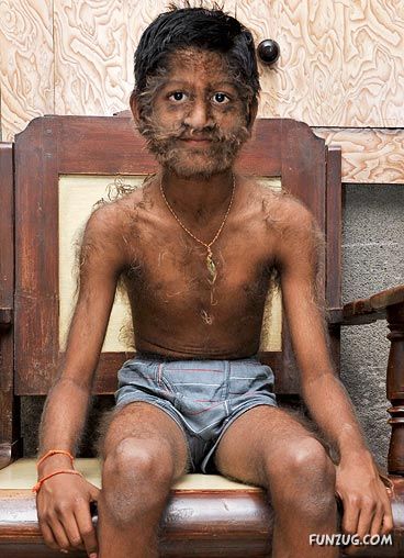 Amazing Hair Boy from India