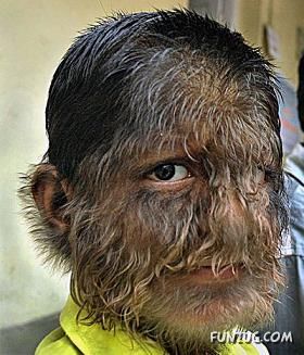 Amazing Hair Boy from India